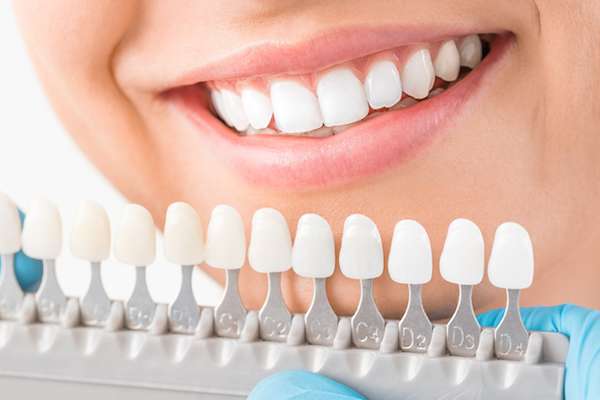 Ask a Cosmetic Dentist: What Are Veneers from White Flint Family Dental in Rockville, MD