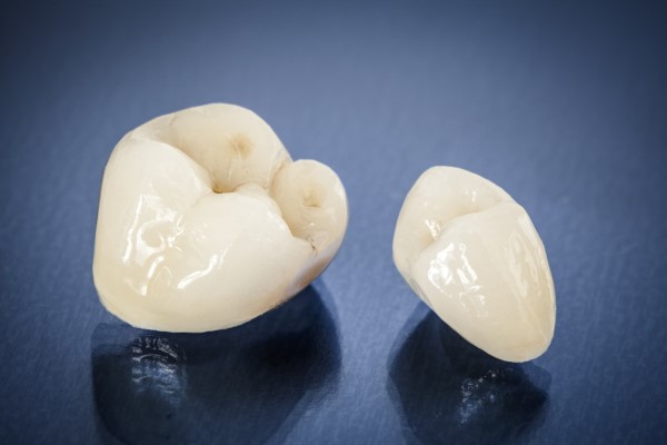 Getting A CEREC Crown Reduces The Amount Of Time And Number Of Visits