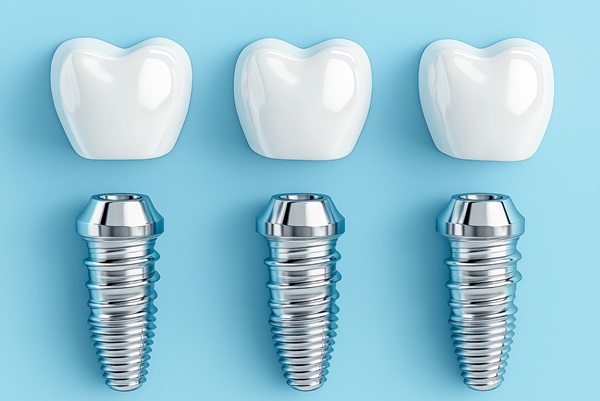 Proper Dental Implant Care In Your Oral Hygiene Routine