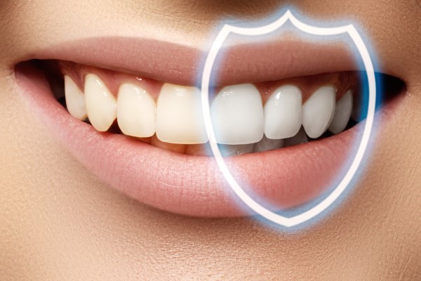 Getting Tooth Whitening At A Dental Practice