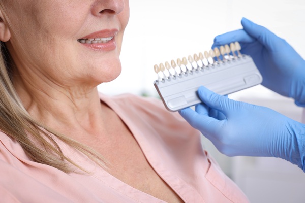 Dental Veneers: What They Treat And How Long Results Can Last