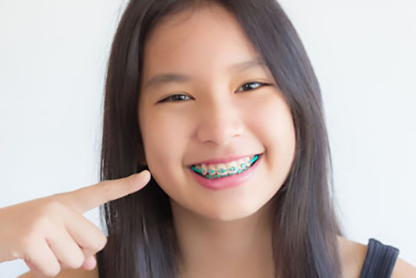 Can A General Dentist Straighten Teeth?