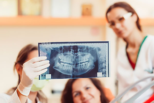 General Dentistry: Why Do I Need Have X Rays Done?