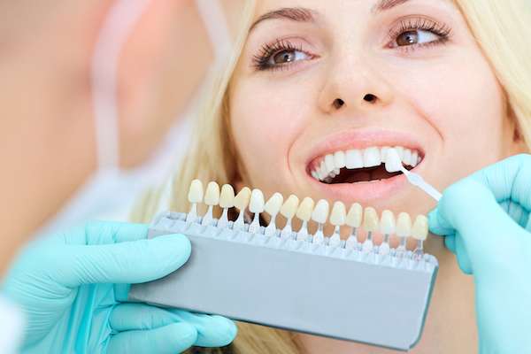 How a Cosmetic Dentist Places Dental Veneers from White Flint Family Dental in Rockville, MD
