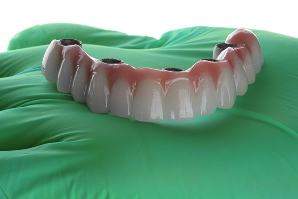 A Brief Comparison Between Implant Supported Dentures And Traditional Dentures