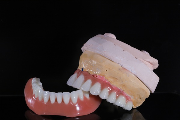 Bring Back A Stronger Smile With Implant Supported Dentures