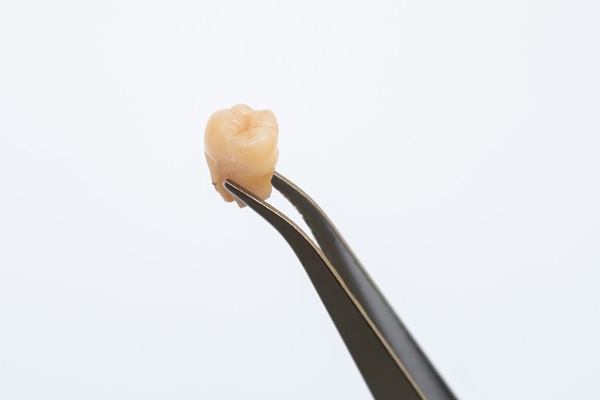 What To Expect During A Tooth Extraction: A Guide To A Smooth Recovery