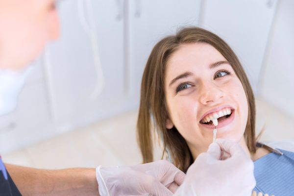 Will Dental Veneers Stay White?